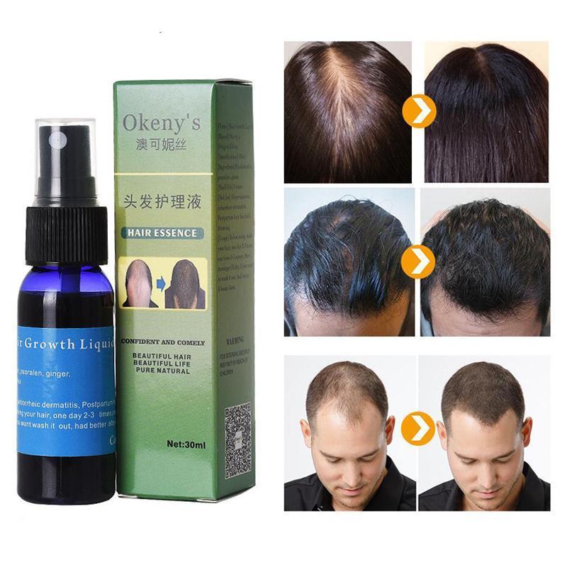 Sunburst Hair Growth Products for women&men anti hair loss products Alopecia Baldness beard oil growth Hair growth spray My Store