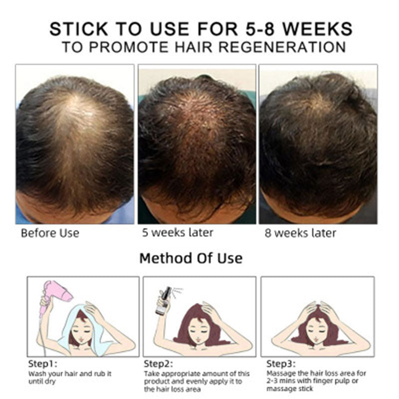 Hair Growth Oil Hair Growth Oil Oem Hair Care Essential Oil My Store