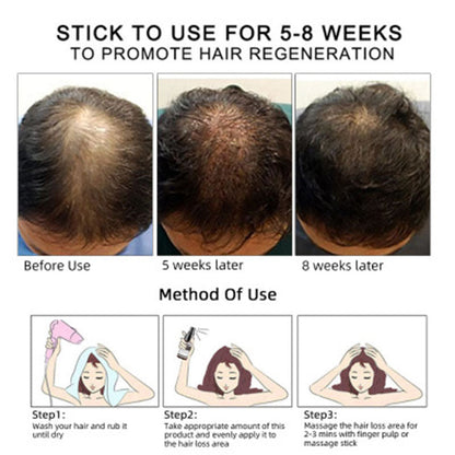 Hair Growth Oil Hair Growth Oil Oem Hair Care Essential Oil My Store