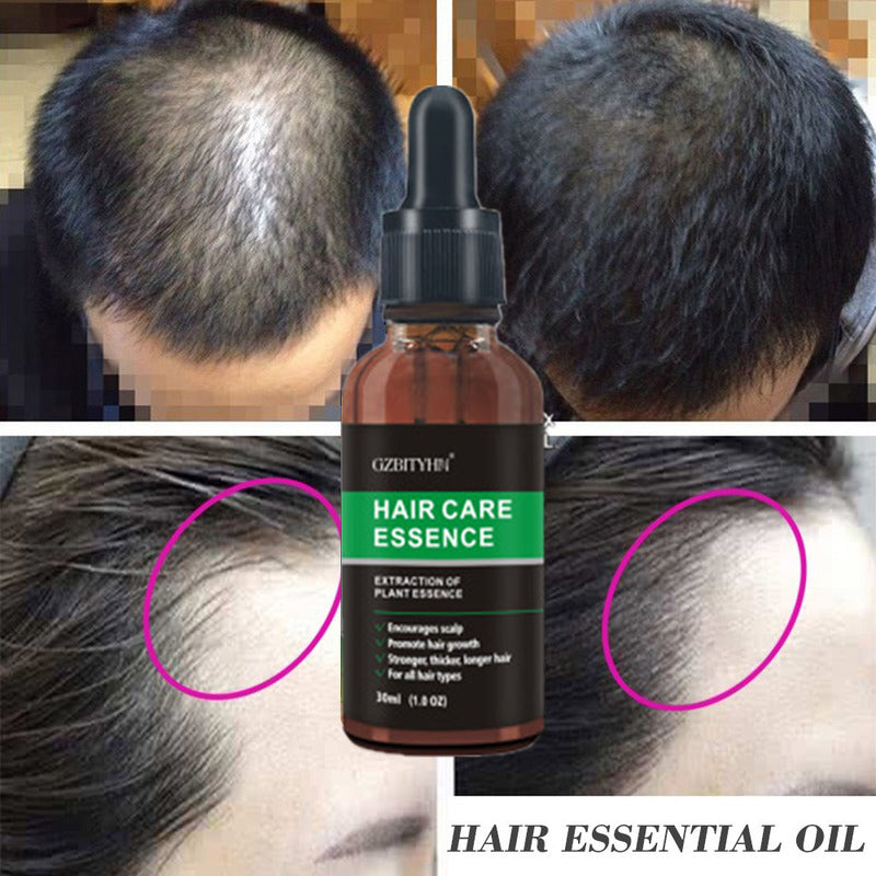 Hair Growth Oil Hair Growth Oil Oem Hair Care Essential Oil My Store