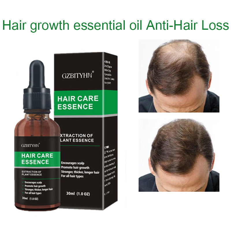 Hair Growth Oil Hair Growth Oil Oem Hair Care Essential Oil My Store