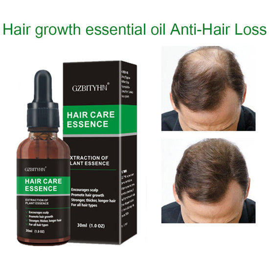 Hair Growth Oil Hair Growth Oil Oem Hair Care Essential Oil My Store