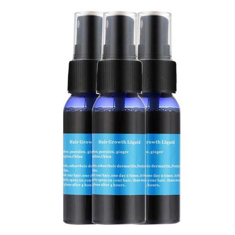 Sunburst Hair Growth Products for women&amp;men anti hair loss products Alopecia Baldness beard oil growth Hair growth spray My Store