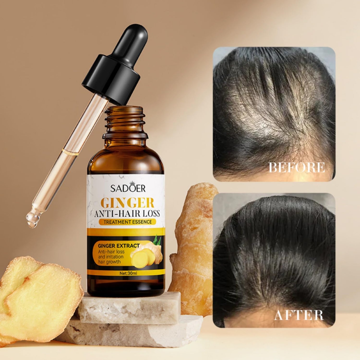Ginger Care Oil Hair Loss Growth My Store