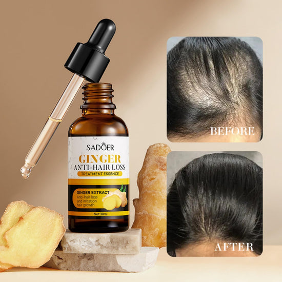 Ginger Care Oil Hair Loss Growth My Store